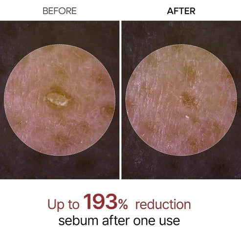 Final 3 Hours: 40% OFF🔥 Gentle Exfoliator Glow Rice Ampoule-Suitable for All Skin Types