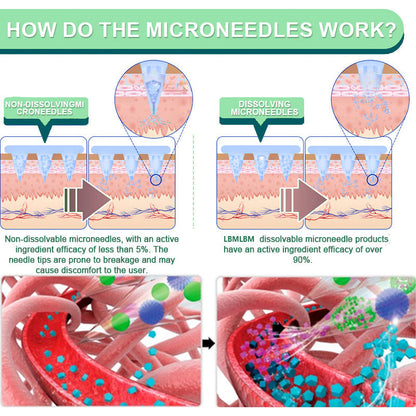 【Last Day Promotion 80% OFF🔥】LOVILDS™ NIDDK-Tirzepatide Slimming & health NANO MICRONEEDLE PATCH🇺🇸👨‍⚕️（Zero Pain, 24/7 Release | Lose 20lbs FAST | 90% Sugar Drop | ）🔥