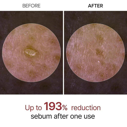 Final 3 Hours: 40% OFF🔥 Gentle Exfoliator Glow Rice Ampoule-Suitable for All Skin Types